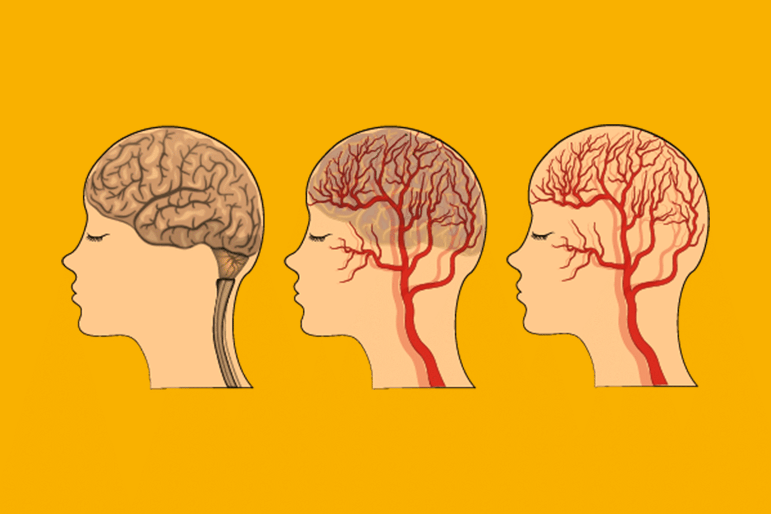 d-couverte-de-l-origine-de-la-baisse-de-l-afflux-c-r-bral-de-sang-dans